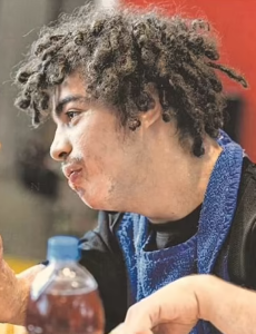 A young man with light-brown skin, photographed in profile. His brown hair is in short dreads, and he has a fuzzy mustache. He is wearing a black T-shirt and blue bib. Burn scars are visible on his face and the stub of his hand.