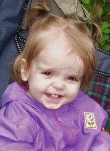 Photo of a toddler girl with strawberry-blonde hair and pale skin. She has a large forehead. Her wispy hair is pulled into two ponytails on top of her head. She is wearing a purple sweater. Her smile shows her two front baby teeth.