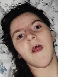 Photo of Marion Reynolds, a young woman with pale skin and dark brown curly hair. She is lying on a pillow, and her mouth is slightly open, showing crooked teeth.