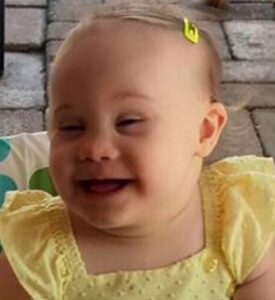 Photo of a baby with Down syndrome. She has fair skin and wispy blonde hair and is smiling broadly. She is wearing a yellow sundress, and has a yellow hair clip in her hair.