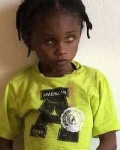 Photo of a young boy, dark-skinned with small braids and a solemn expressionn. He is wearing a bright-yellow T-shirt with the letter A on the front. One of his eyes has a cataract.