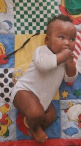 A baby lies on his side on a colorful quilt. The baby is a chubby boy, sucking on his hands, wearing a white romper. His skin is brown, and he has curly black hair just on the top of his head. His eyes are milky with cataracts.