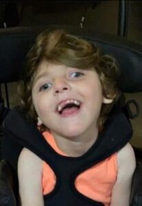Photo of a little girl with fair skin and brown wavy hair; she is wearing an organ tank top and is smiling, showing two missing front teeth, head tilted back. One eye is turned to the side. SHe is wearing a harness to hold her in her chair.