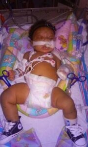 Photo of a baby girl sleeping on a colorful blanket, wearing a diaper and blue high-top sneakers. She has light-brown skin and dark curly hair. She has a ventilator tube in her mouth and three sensors stuck to her chest.