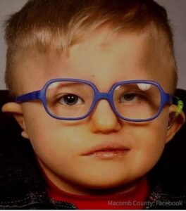 Photo of a young boy with pale skin and fine blond hair, wearing blue-rimmed glasses. His face is somewhat asymmetrical and his mouth pulls to one side; his ears stick out below the earpieces of his glasses.