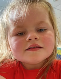 Photo of a toddler girl with silky, white-blond hair, fair skin and red cheeks. She is wearing a red shirt.