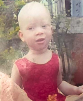 Photo of an African toddler girl. She has light skin and her head is shaved. She is wearing a red sundress.
